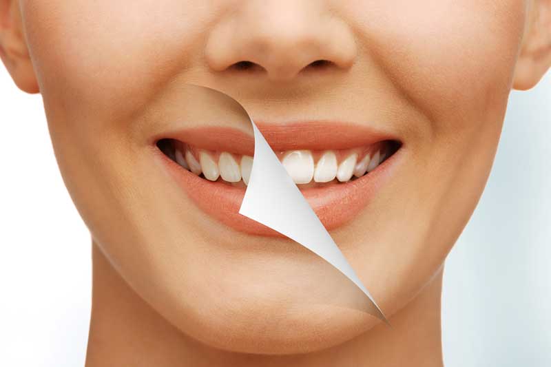 teeth-whitening-treatments-banner Dr keri with patient